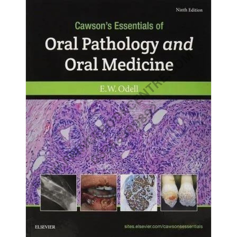 Cawson’s Essentials of Oral Pathology and Oral Medicine 9th Edition ...